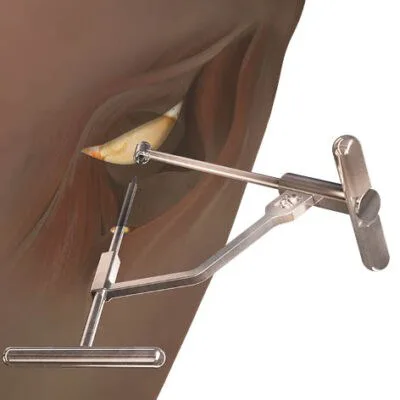 Hüfte Anterior path 1