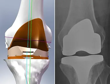 Knee image patient section 3