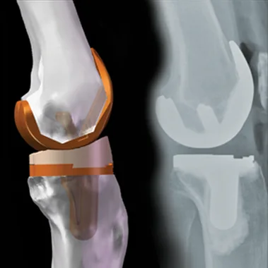 Knee image patient section 4