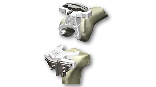 Knie Prophecy Evolution image 540x300 1